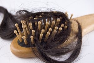 Příčiny padání vlasů - TRICHOL