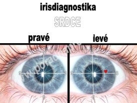 PORADNA - ZDRAVÍ - IRIS SRDCE