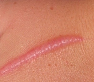 Image 0